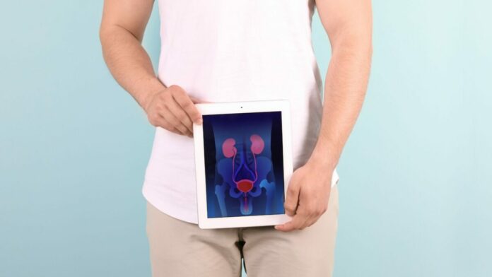 schéma d'une prostate sur un écran